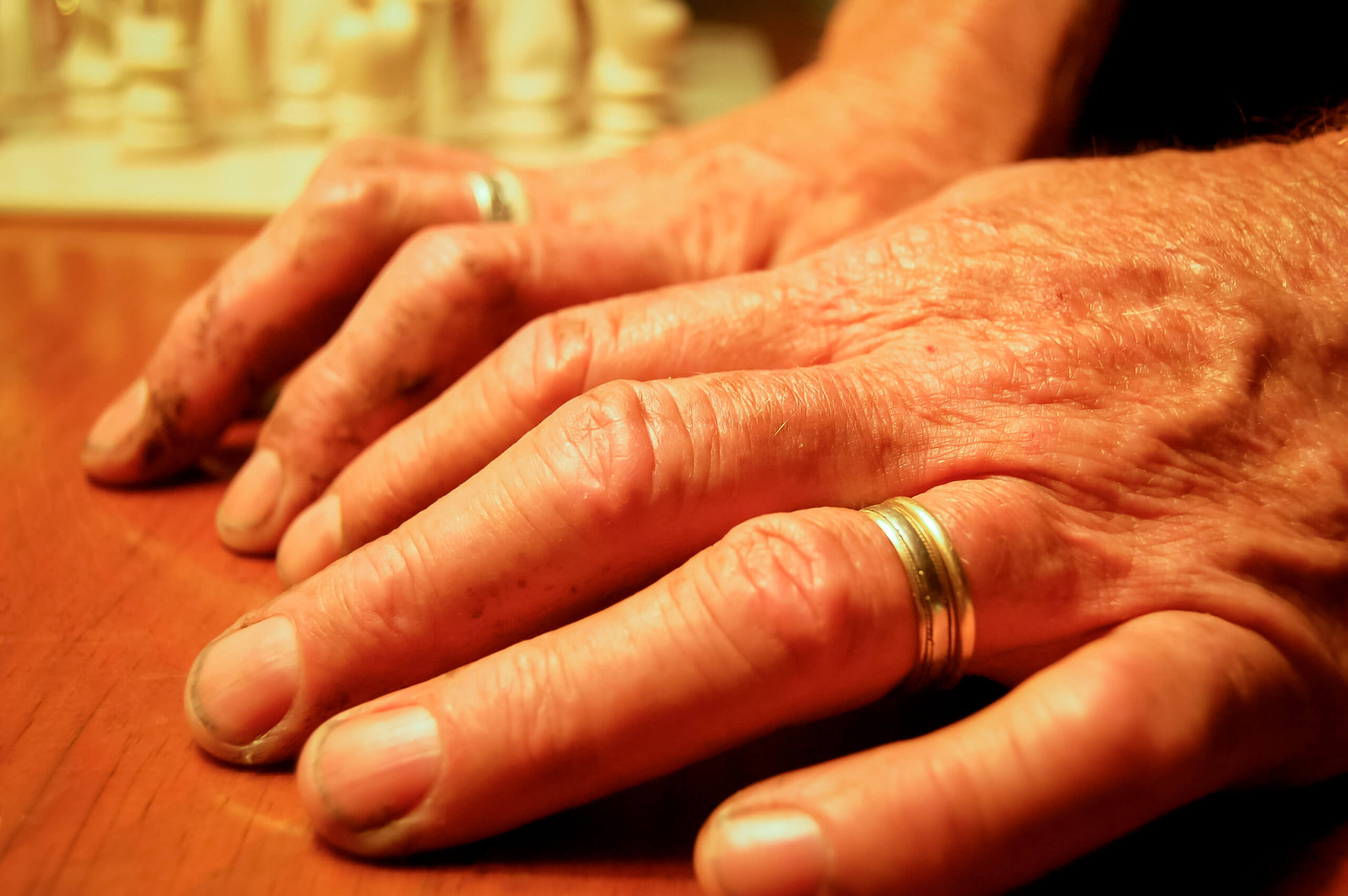 A pair of hands are shown. The hands are wrinkled, tanned, and have dirt under the fingernails and on the skin. Rings are worn on both hands.